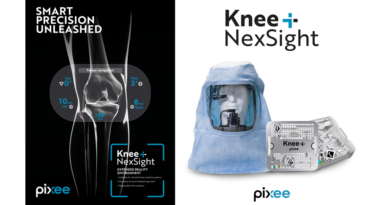 Knee+ NexSight : guidage AR pour prothèse de genou – Pixee Medical
